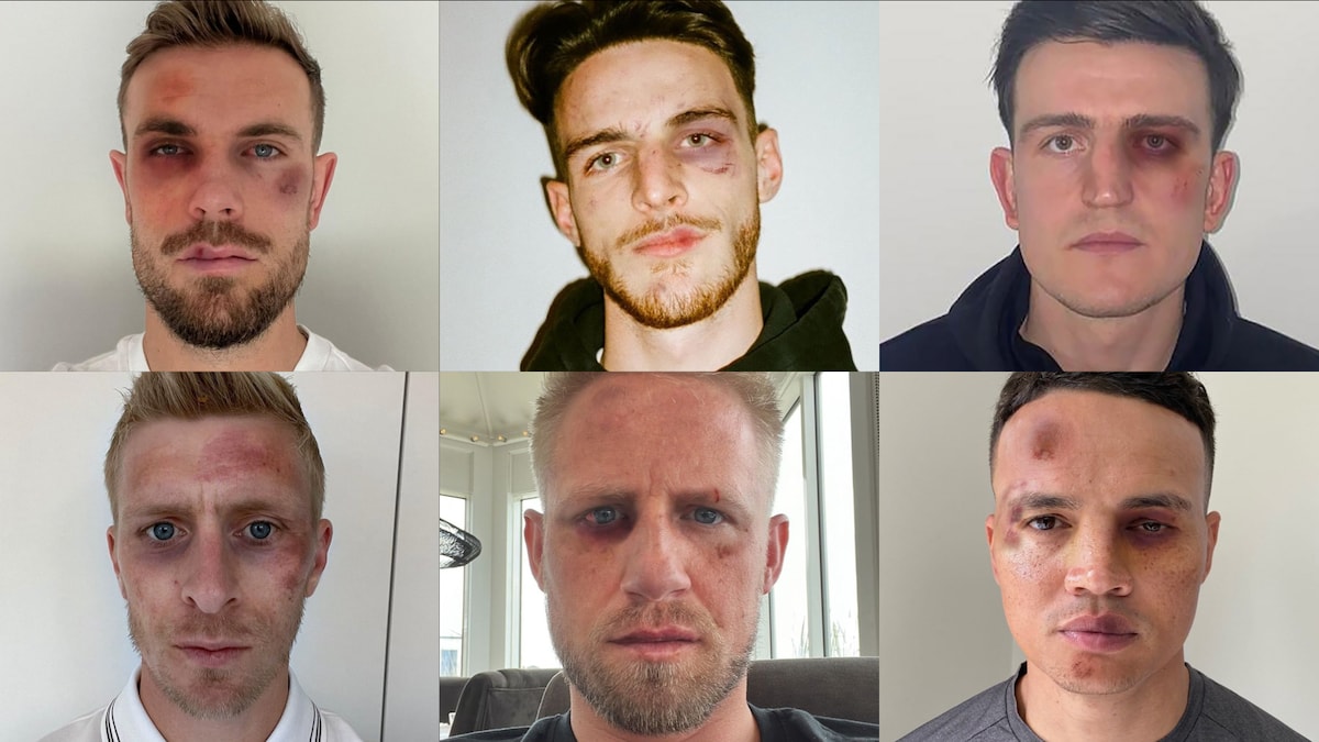 Premier League footballers reveal impact of social media abuse with bruised faces for Stop Cyberbullying Day
